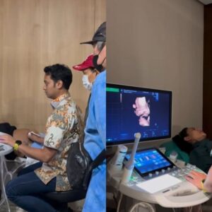 Erika Carlina Bagikan Momen USG usai Akui Hamil 9 Bulan di Luar Nikah, Siap Melahirkan Agustus
