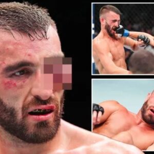 Cedera Parah, Bintang UFC Mohammad Yahya Terancam Kehilangan Mata